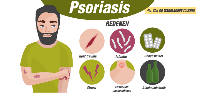  Belangrijkste oorzaken van psoriasis